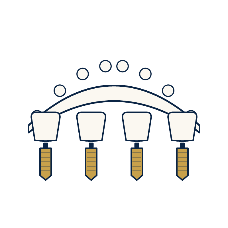 All-on-4 dental implants in Turkey