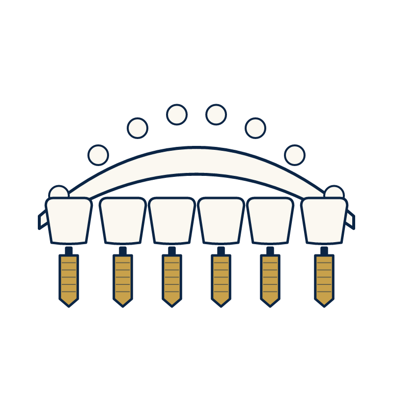 All-on-6 dental implants in Turkey